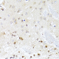 Immunohistochemistry of paraffin-embedded Mouse brain using EGLN1/EGLN2 Polyclonal Antibody at dilution of 1:100 (40x lens) .