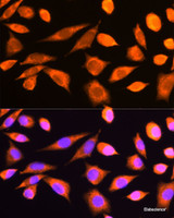 Immunofluorescence analysis of L929 cells using RPS20 Polyclonal Antibody at dilution of 1:100. Blue: DAPI for nuclear staining.