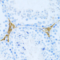 Immunohistochemistry of paraffin-embedded Mouse testis leydig using KLHL42 Polyclonal Antibody at dilution of 1:100 (40x lens) .