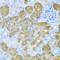 Immunohistochemistry of paraffin-embedded Mouse kidney using KLHL42 Polyclonal Antibody at dilution of 1:100 (40x lens) .