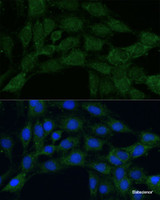Immunofluorescence analysis of C6 cells using MTHFD2 Polyclonal Antibody at dilution of 1:100. Blue: DAPI for nuclear staining.