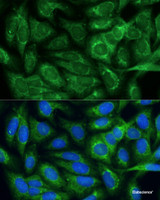 Immunofluorescence analysis of U-2 OS cells using MTHFD2 Polyclonal Antibody at dilution of 1:100. Blue: DAPI for nuclear staining.
