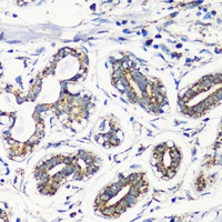 Immunohistochemistry of paraffin-embedded Human breast using MMP16 Polyclonal Antibody at dilution of 1:100 (40x lens) .