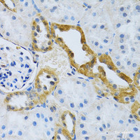 Immunohistochemistry of paraffin-embedded Rat kidney using SLC4A5 Polyclonal Antibody at dilution of 1:100 (40x lens) .