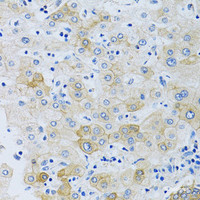 Immunohistochemistry of paraffin-embedded Human liver using SLC4A5 Polyclonal Antibody at dilution of 1:100 (40x lens) .