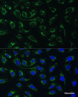 Immunofluorescence analysis of U-2 OS cells using AKR1C2 Polyclonal Antibody at dilution of 1:100 (40x lens) . Blue: DAPI for nuclear staining.