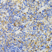 Immunohistochemistry of paraffin-embedded Mouse spleen using TREM2 Polyclonal Antibody at dilution of 1:200 (40x lens) .