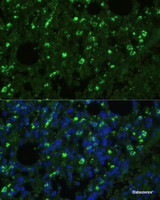 Immunofluorescence analysis of Mouse lung cells using TREM2 Polyclonal Antibody at dilution of 1:100. Blue: DAPI for nuclear staining.