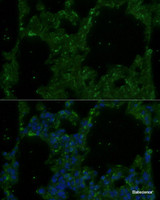 Immunofluorescence analysis of Rat lung using TREM2 Polyclonal Antibody at dilution of 1:100. Blue: DAPI for nuclear staining.