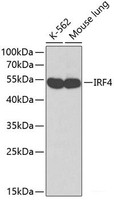 Western blot analysis of extracts of various cell lines using IRF4 Polyclonal Antibody.