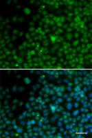 Immunofluorescence analysis of U2OS cells using IRF4 Polyclonal Antibody