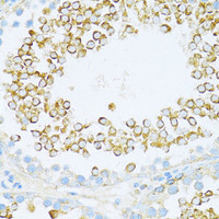 Immunohistochemistry of paraffin-embedded Rat testis using DVL1 Polyclonal Antibody at dilution of 1:100 (40x lens) .