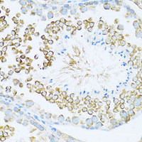 Immunohistochemistry of paraffin-embedded Mouse testis using DVL1 Polyclonal Antibody at dilution of 1:100 (40x lens) .