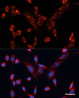Immunofluorescence analysis of NIH/3T3 cells using DVL1 Polyclonal Antibody at dilution of 1:100. Blue: DAPI for nuclear staining.