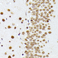 Immunohistochemistry of paraffin-embedded Rat brain using PRMT1 Polyclonal Antibody at dilution of 1:100 (40x lens) .