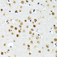 Immunohistochemistry of paraffin-embedded Mouse brain using PRMT1 Polyclonal Antibody at dilution of 1:100 (40x lens) .