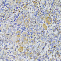 Immunohistochemistry of paraffin-embedded Rat spleen using Slug Polyclonal Antibody at dilution of 1:100 (40x lens) .