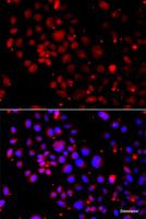 Immunofluorescence analysis of A549 cells using Slug Polyclonal Antibody