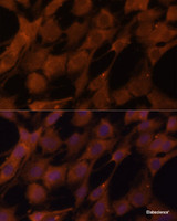 Immunofluorescence analysis of C6 cells using LGMN Polyclonal Antibody at dilution of 1:100 (40x lens) . Blue: DAPI for nuclear staining.