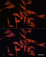 Immunofluorescence analysis of HeLa cells using LGMN Polyclonal Antibody at dilution of 1:100 (40x lens) . Blue: DAPI for nuclear staining.