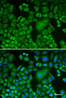 Immunofluorescence analysis of HeLa cells using ACTR3 Polyclonal Antibody