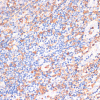 Immunohistochemistry of paraffin-embedded Human tonsil using CYBA Polyclonal Antibody at dilution of 1:100 (40x lens) .