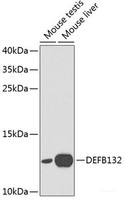 Western blot analysis of extracts of various cell lines using DEFB132 Polyclonal Antibody at dilution of 1:1000.