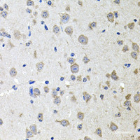 Immunohistochemistry of paraffin-embedded Mouse brain using ALPL Polyclonal Antibody at dilution of 1:100 (40x lens) .