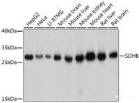 Western blot analysis of extracts of various cell lines using SDHB Polyclonal Antibody at dilution of 1:1000.