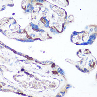 Immunohistochemistry of paraffin-embedded Human placenta using p38 MAPK Polyclonal Antibody at dilution of 1:100 (40x lens) .