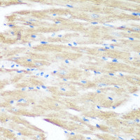 Immunohistochemistry of paraffin-embedded Mouse heart using p38 MAPK Polyclonal Antibody at dilution of 1:100 (40x lens) .