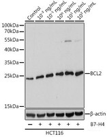 Western blot analysis of extracts of HCT116 cells using Bcl-2 Polyclonal Antibody at dilution of 1:1000. HCT116 cells treated with different concentRations of B7-H4.