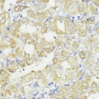 Immunohistochemistry of paraffin-embedded Human stomach using Bcl-2 Polyclonal Antibody at dilution of 1:100 (40x lens) .
