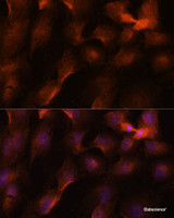 Immunofluorescence analysis of C6 cells using BRCA1 Polyclonal Antibody at dilution of 1:100. Blue: DAPI for nuclear staining.