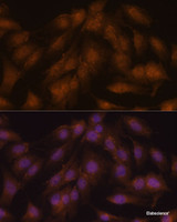 Immunofluorescence analysis of C6 cells using CDKN2A / p16INK4a Polyclonal Antibody at dilution of 1:100. Blue: DAPI for nuclear staining.