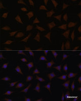 Immunofluorescence analysis of L929 cells using CDKN2A / p16INK4a Polyclonal Antibody at dilution of 1:100. Blue: DAPI for nuclear staining.