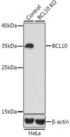 Western blot analysis of extracts from normal (control) and BCL10 knockout (KO) HeLa cells using BCL10 Polyclonal Antibody at dilution of 1:1000.