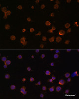 Immunofluorescence analysis of THP-1 cells using CTGF Polyclonal Antibody at dilution of 1:100. Blue: DAPI for nuclear staining.