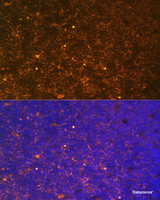 Immunofluorescence analysis of Rat thymus using CTGF Polyclonal Antibody at dilution of 1:100. Blue: DAPI for nuclear staining.