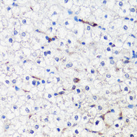 Immunohistochemistry of paraffin-embedded Human liver using HO-1 Polyclonal Antibody at dilution of 1:200 (40x lens) .