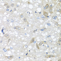 Immunohistochemistry of paraffin-embedded Rat brain using IL6 Polyclonal Antibody at dilution of 1:100 (40x lens) .