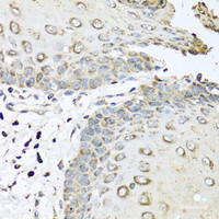 Immunohistochemistry of paraffin-embedded Human esophagus using IL6 Polyclonal Antibody at dilution of 1:100 (40x lens) .