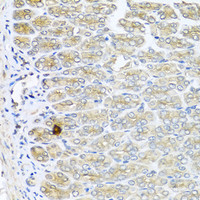 Immunohistochemistry of paraffin-embedded Mouse stomach using IL6 Polyclonal Antibody at dilution of 1:100 (40x lens) .