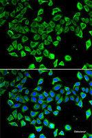 Immunofluorescence analysis of A-549 cells using LCN2 Polyclonal Antibody