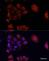Immunofluorescence analysis of HeLa cells using DAZL Polyclonal Antibody at dilution of 1:100. Blue: DAPI for nuclear staining.