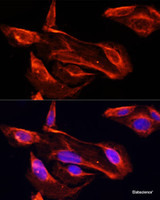 Immunofluorescence analysis of U2OS cells using MMP2 Polyclonal Antibody at dilution of 1:100. Blue: DAPI for nuclear staining.