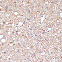 Immunohistochemistry of paraffin-embedded Human liver using MMP9 Polyclonal Antibody at dilution of 1:100 (40x lens) .