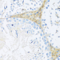 Immunohistochemistry of paraffin-embedded Mouse leydig cells using NRF2 Polyclonal Antibody at dilution of 1:100 (40x lens) .