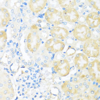 Immunohistochemistry of paraffin-embedded Mouse kidney using NRF2 Polyclonal Antibody at dilution of 1:100 (40x lens) .