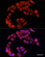 Immunofluorescence analysis of HeLa cells using NRF2 Polyclonal Antibody at dilution of 1:100. Blue: DAPI for nuclear staining.